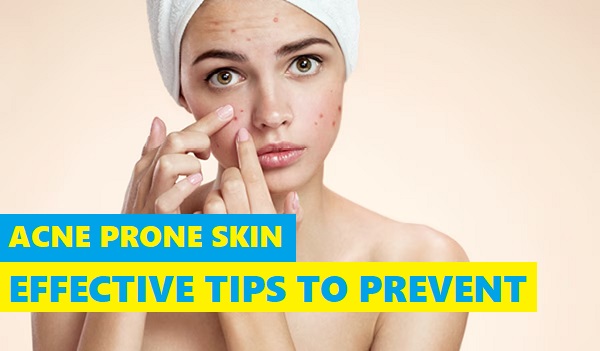 Effective Skincare Tips to Treat Acne-Prone Skin