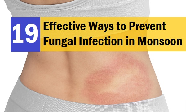 Effective Ways to Prevent Fungal Infection During Humid Weather