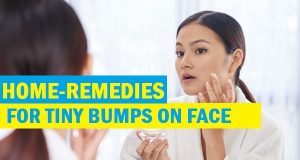 Home Remedies for Tiny Bumps on Face