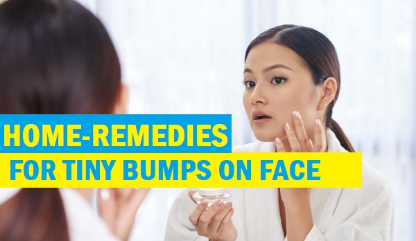 Home Remedies for Tiny Bumps on Face