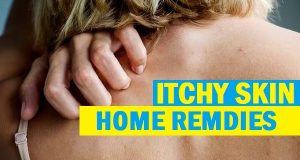 home remedies for itchy skin