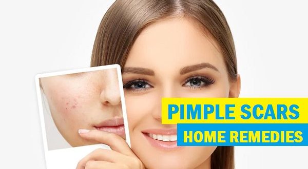 try-these-25-tested-home-remedies-for-pimple-scars-removal-quickly